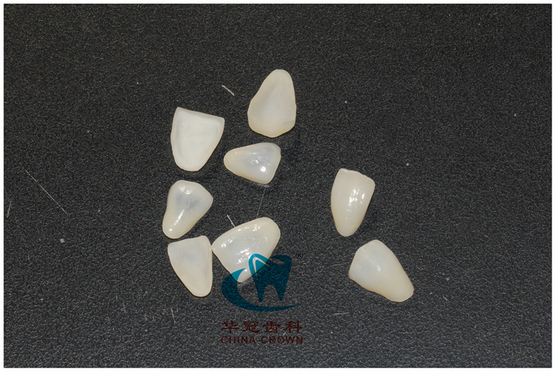 DSMR超晶瓷貼面